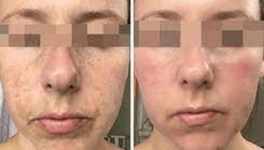 Image for MandeliClear Peel with Vitamin A