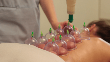 Image for Cupping Massage Treatment